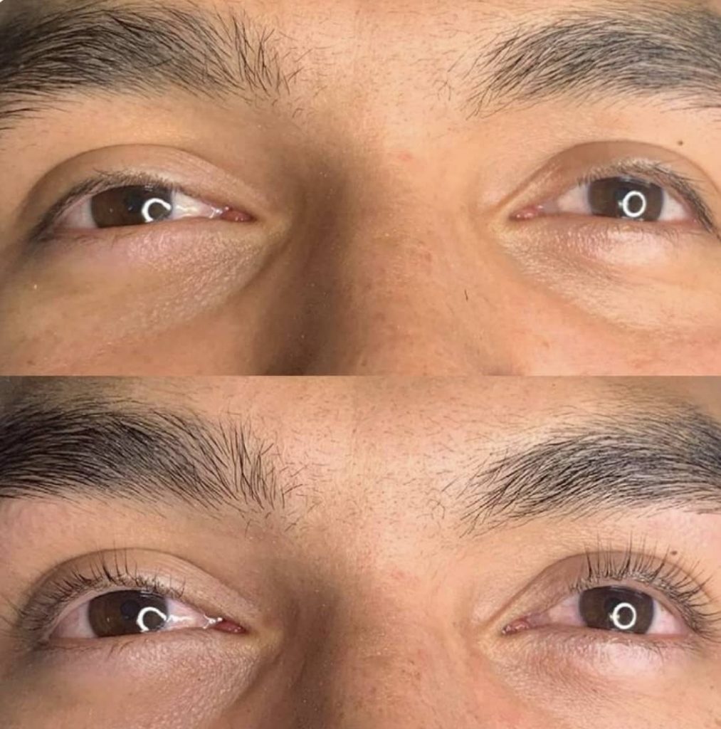Avant-après en plan rapproché d'un homme aux yeux bruns ayant reçu un rehaussement des cils